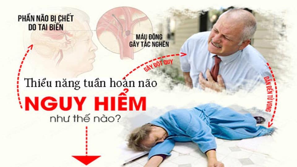 Tăng Cường Tuần Hoàn Não